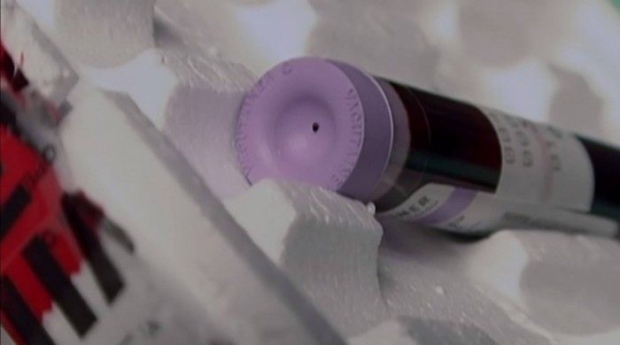 murhaaja-104-veri-heikko-neulanreiän tekeminen